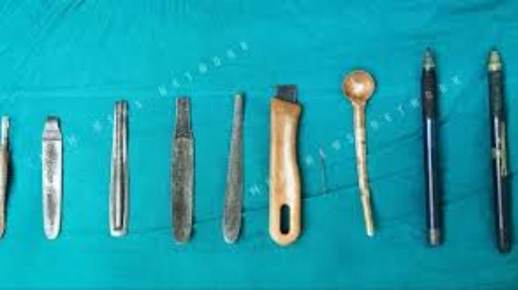 Himachal- Knife- needle- pencil- and- 12- other- items- came- out- of- the- patient's- stomach- even- doctors- were- stunned.