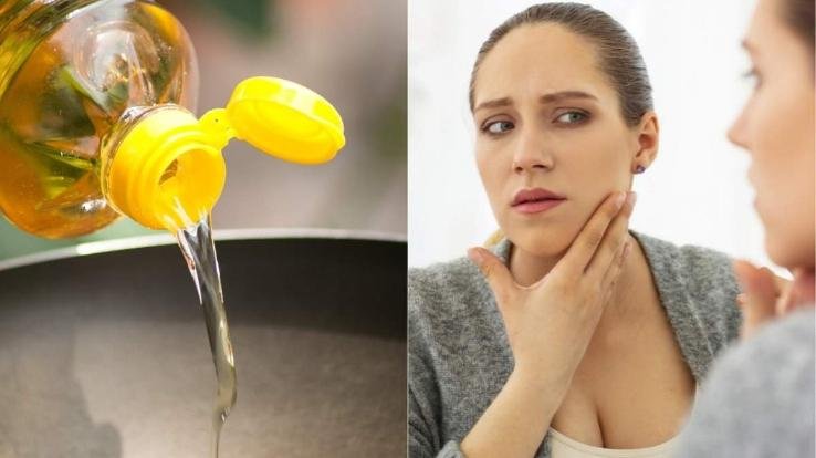 beauty-hacks-mustard-oil-massage-reduces-dark-spots