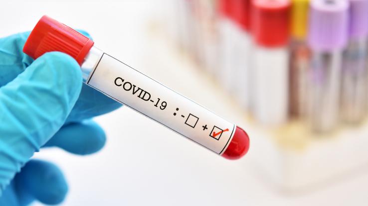 4 people found corona positive in RT-PCR test
