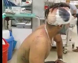 On the day of Holi, a young man clashed with you over something, attacked with sticks
