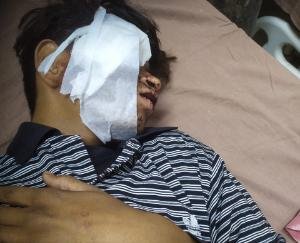 Neighbor assaulted 17 year old prince and injured him