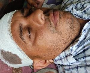 Contract worker beaten with baseball due to a dispute over beer rate