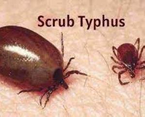  Fourth death due to scrub typhus in IGMC Shimla, 12 new cases