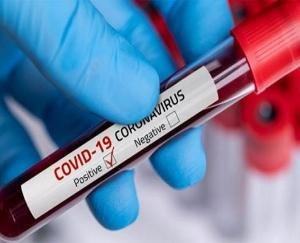 Carena update: 148 new cases in the state, one is out, 67 are fine